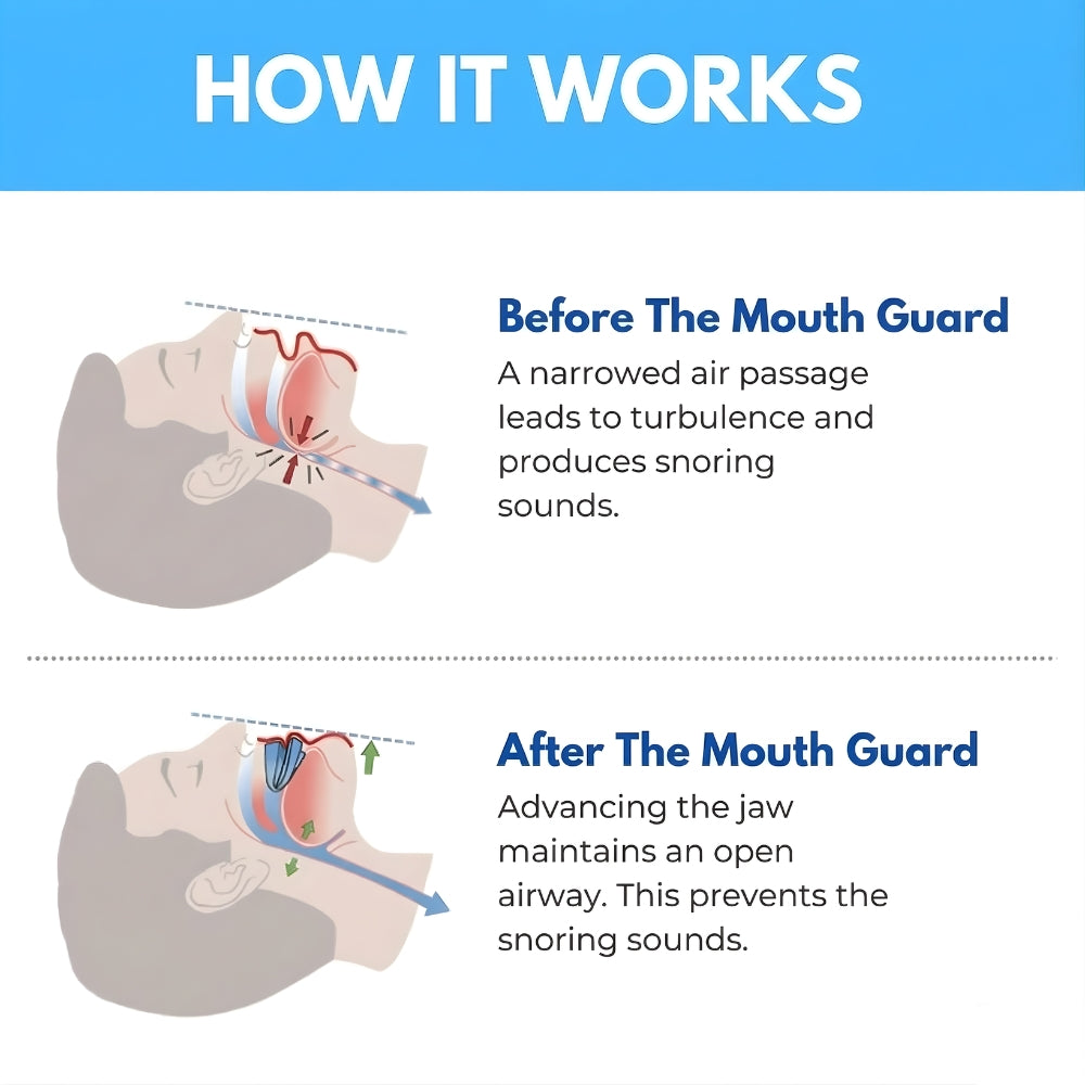 TroveTraders™ - Sleep Apnea & Anti-Snoring Guard