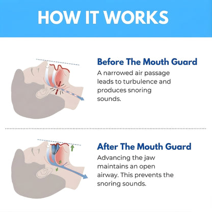 TroveTraders™ - Sleep Apnea & Anti-Snoring Guard